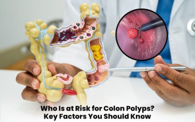 Who Is at Risk for Colon Polyps? Key Factors You Should Know
