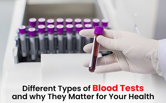 Different Types of Blood Tests and Why They Matter for Your Health
